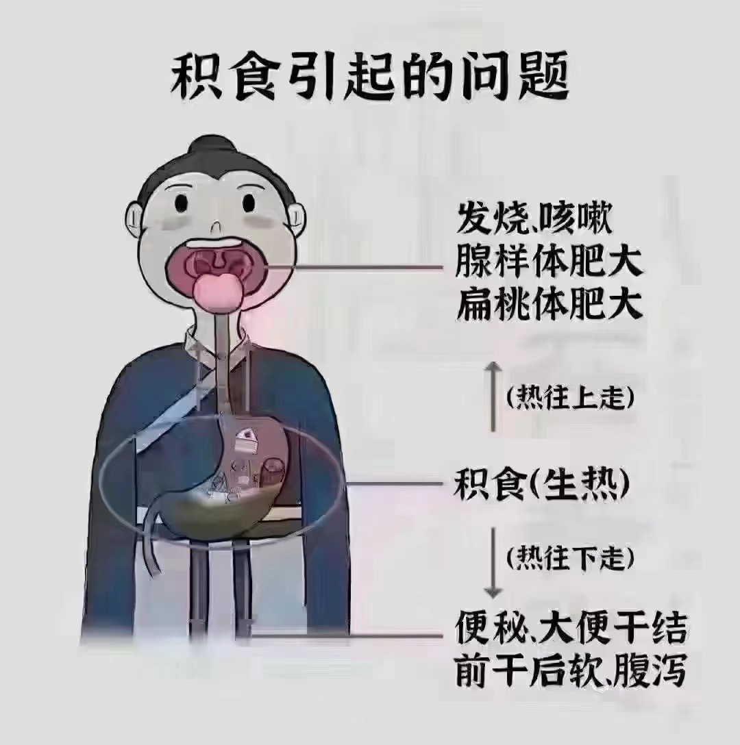 【为什么总是扁桃体发炎，腺样体肥大】脾虚积食是最大帮凶！喂养不当、消化不良、积食