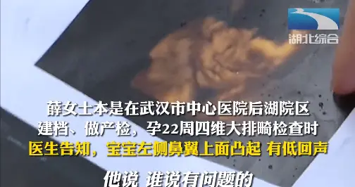 女子产检发现胎儿面部畸形，辗转到同济检查却被告知“没问题”，出生后如同晴天霹雳