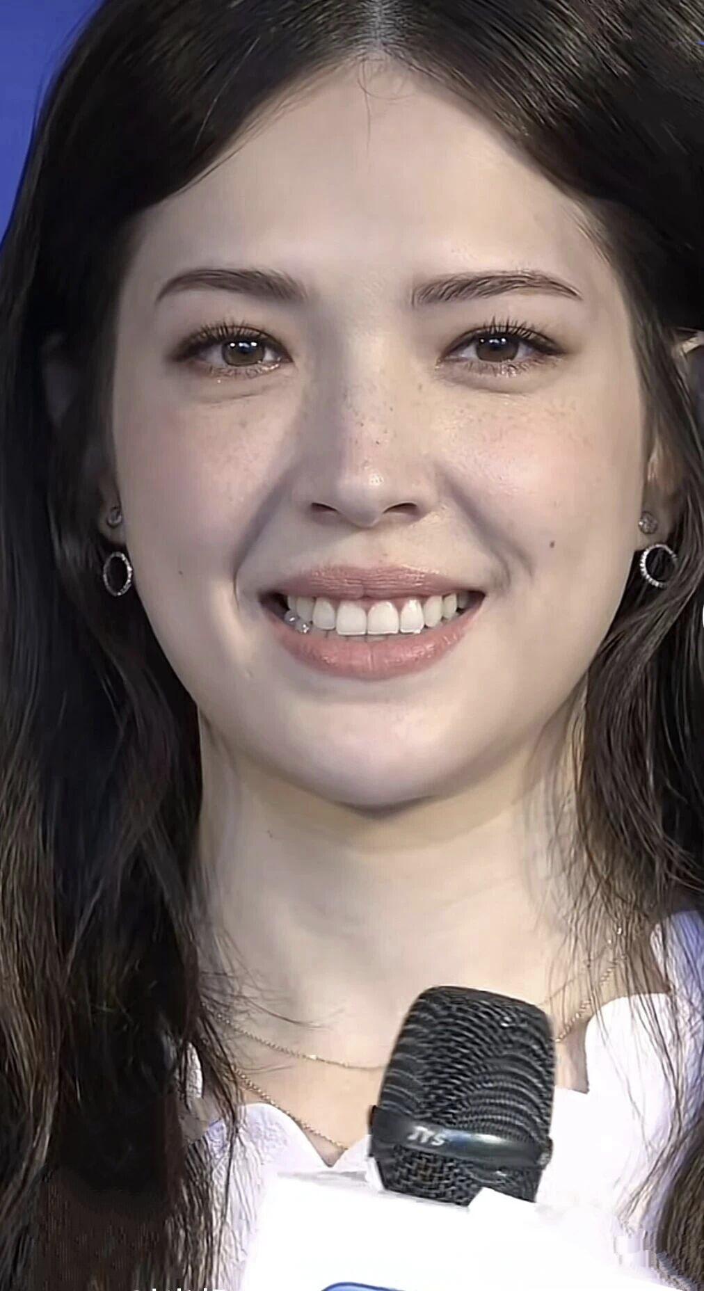 有些人，即便是脸上长雀斑，也是美的，连带着雀斑也很可爱。比如她许玮甯