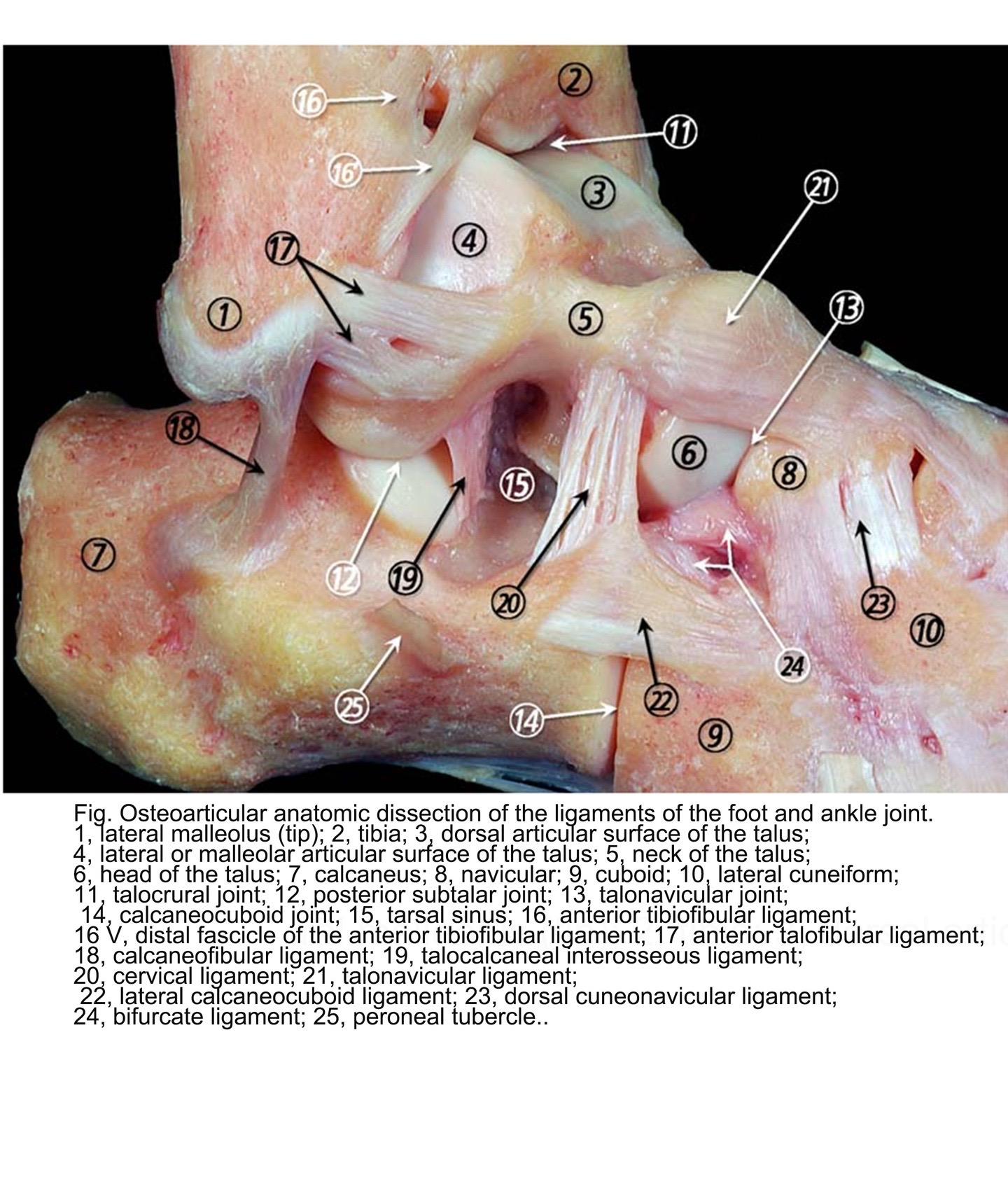 踝关节解剖。踝关节韧带撕裂 踝关节韧带解剖