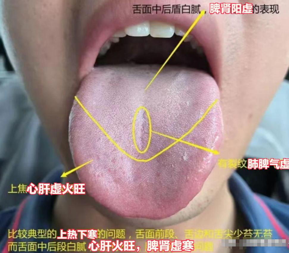 挑战一天解读88个舌象，你晒舌象，秒出结果！

需要注意三点：
1.拍照时不要用
