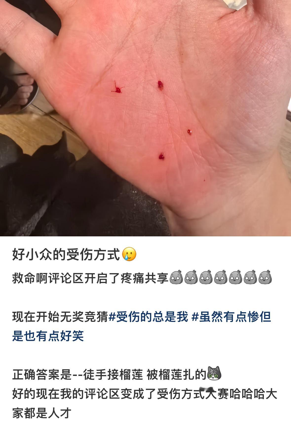 好小众的受伤方式… 
