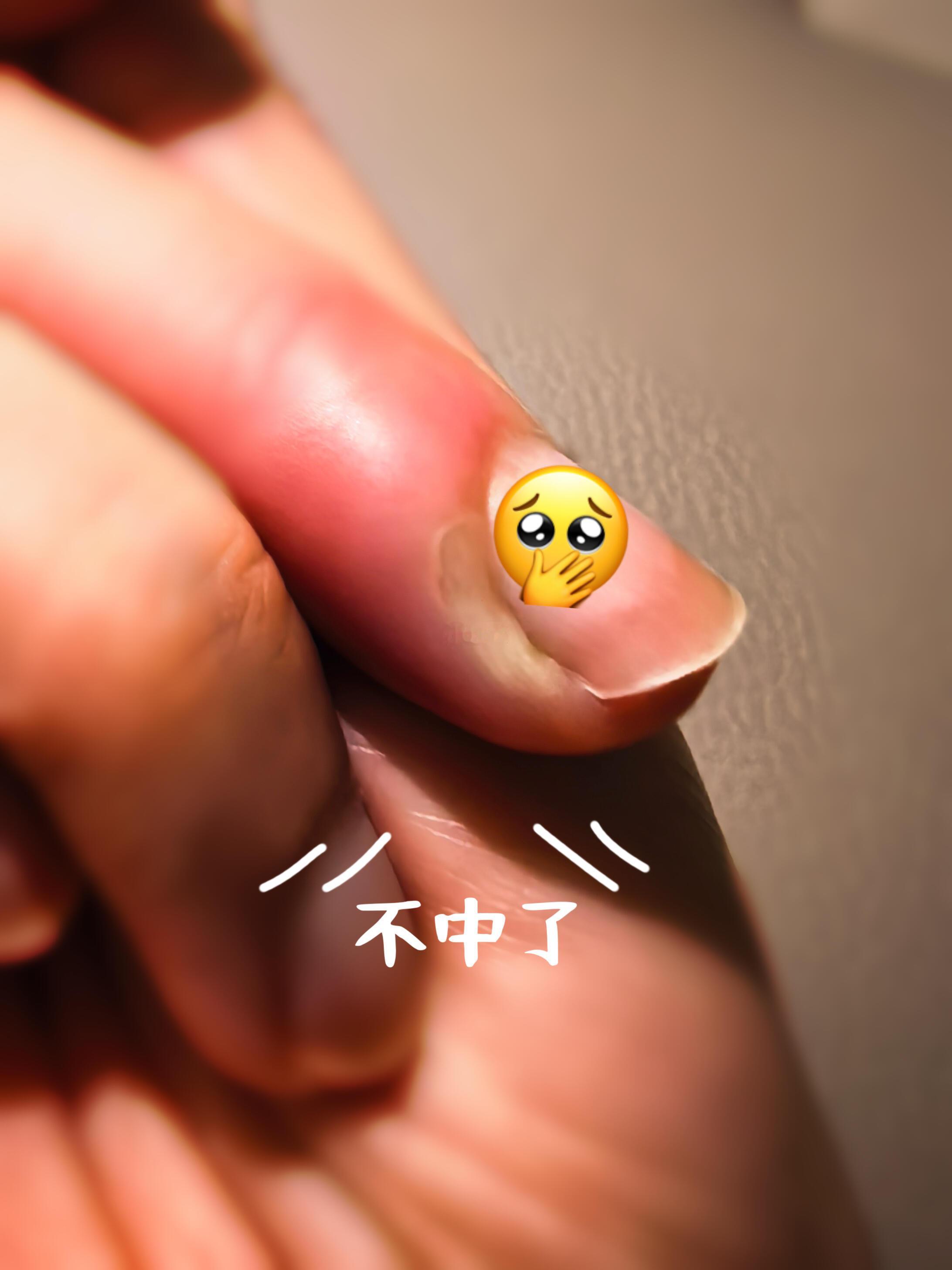 筒子村[超话]  20250829 小🍠更新距离上一次发帖刚好一个月，咋把手指