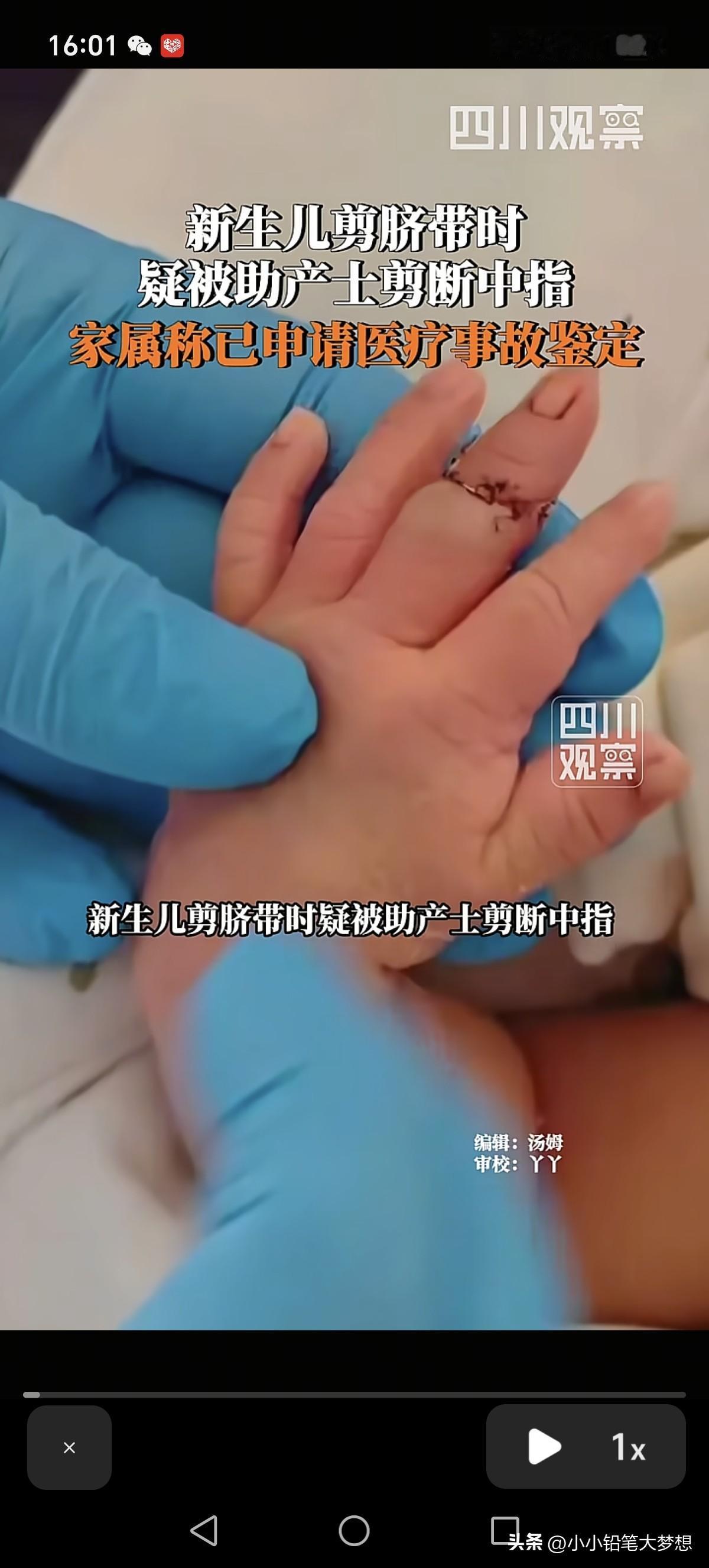 天杀的，太心痛了！新生儿刚刚出生，就被剪断了手指，近日，江苏盱眙一网友爆料自己的