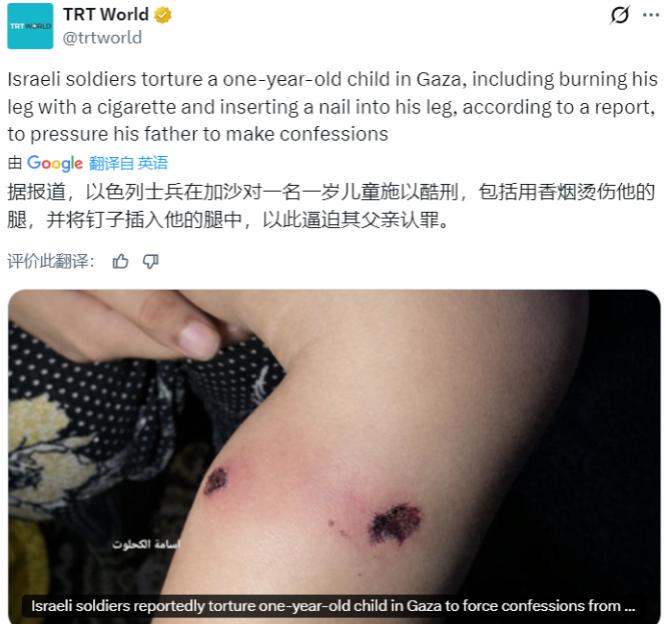 禽兽不如！

据土耳其国家公共广播公司：以色列士兵在加沙对一名一岁儿童施以酷刑，