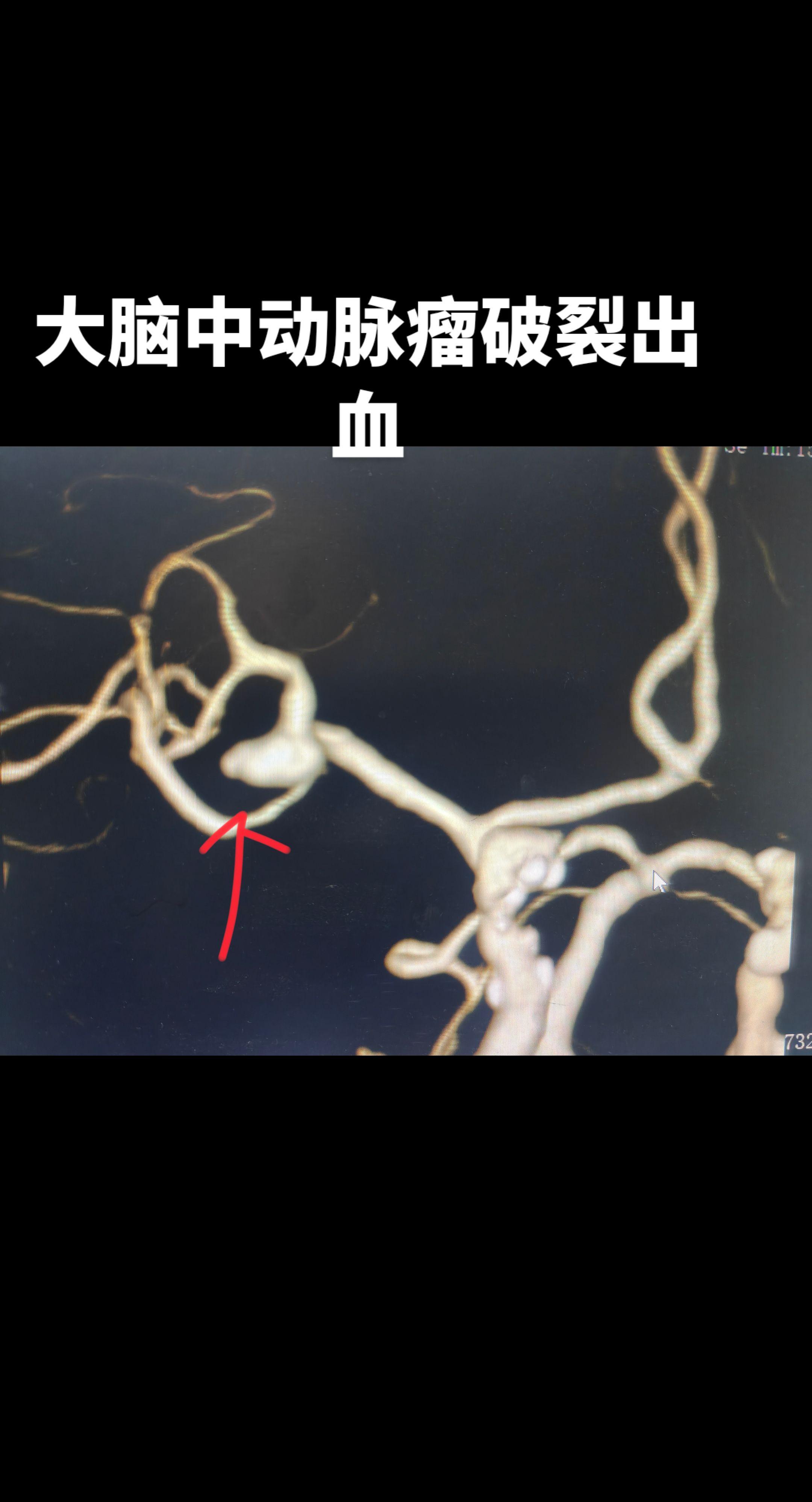 医生日常 医路前行 医者仁心