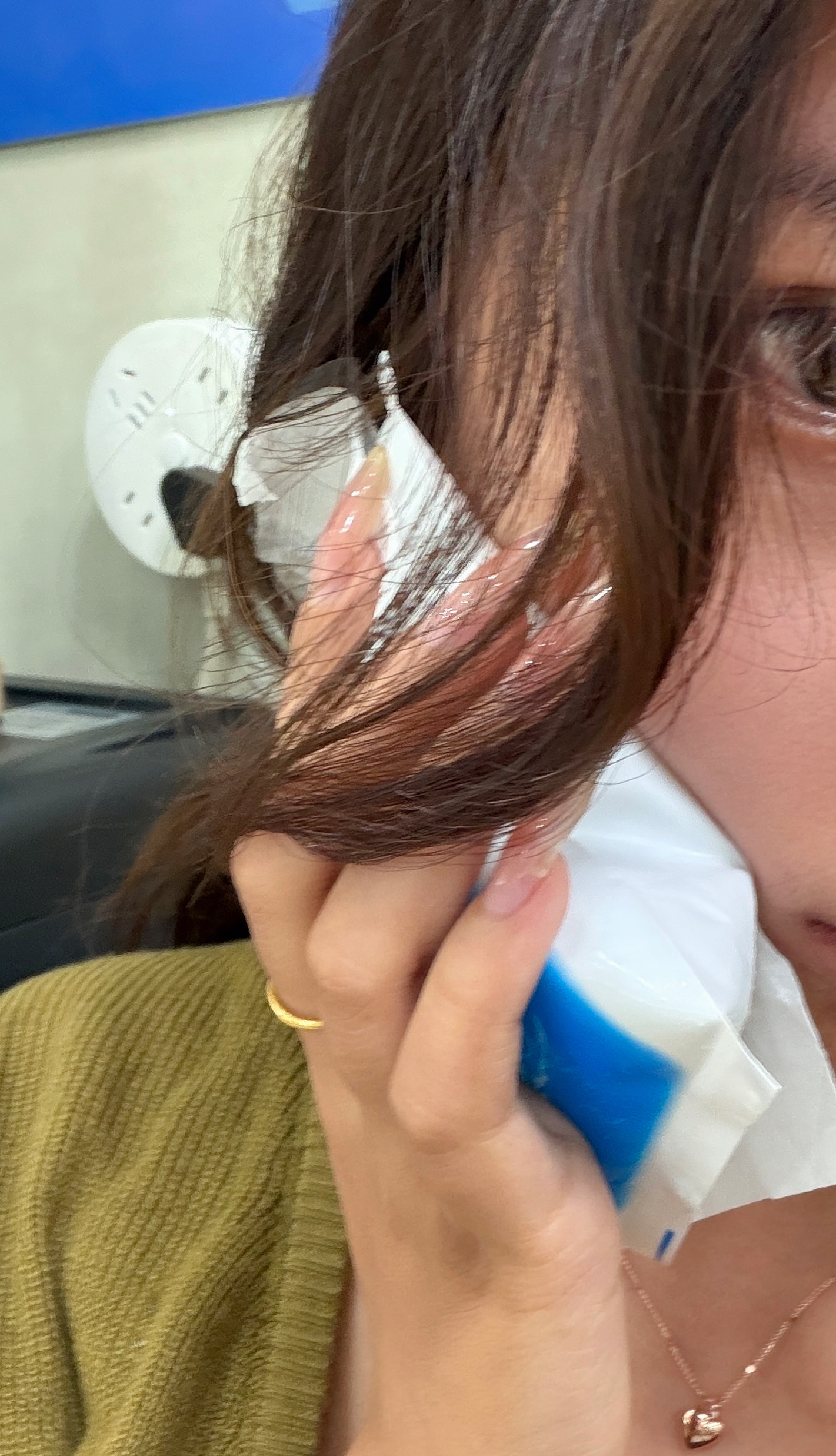 拔了智齿