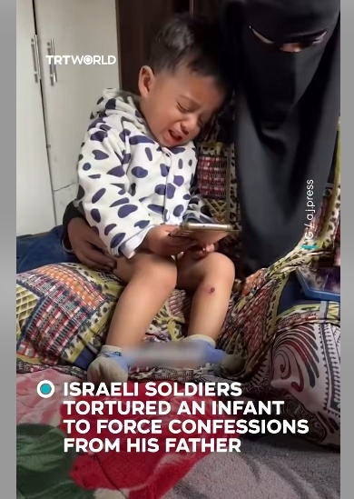 【#以军对18月大婴儿施酷刑逼其父招供# 】土耳其广播电视公司3月24日消息，据