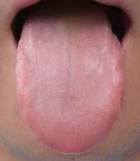 男性虚实夹杂证：肾阴亏虚兼脾胃湿热辨证调理







前天收到一位粉丝的留言