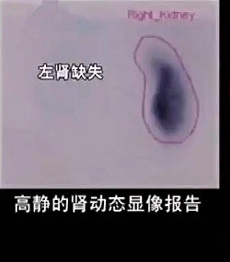 江西贵溪，8岁男孩遭遇车祸，被送去医院，检查报告显示，双肾正常，15岁体检时，却