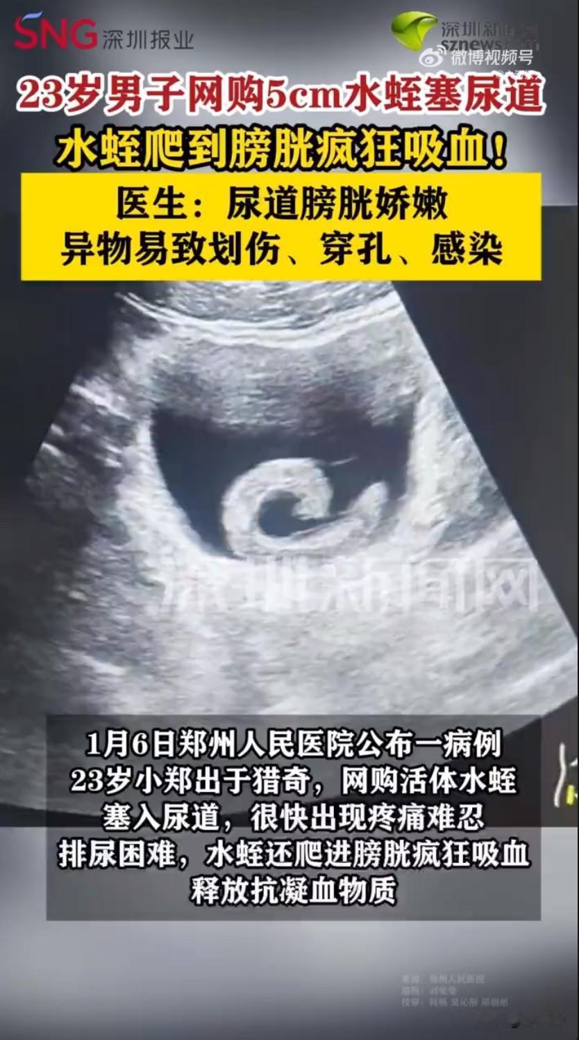 河南郑州一名23岁的小伙子小郑，最近因为一时糊涂的猎奇行为，把自己送进了医院，这