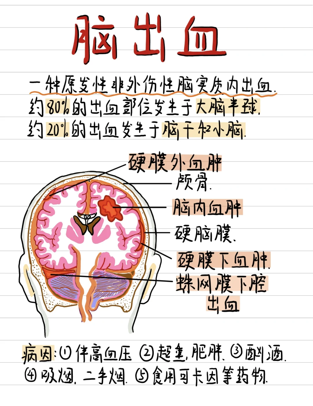 医学生笔记✍️-🧠脑出血你了解多少?