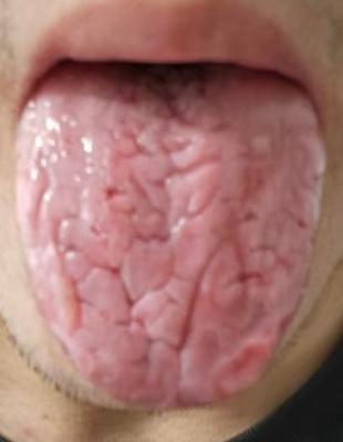 依托脏腑辨证调理，逐步改善局部气血状态，调养身体本源






很多男士朋友们