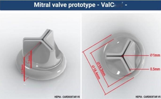 瑞士开发3D打印二尖瓣植入物原型

资源库 / 4月24日消息，日内瓦应用科学与