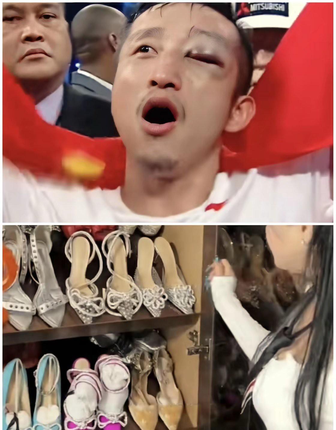 这张照片看的让人心疼，邹市明在台上，为了荣誉，被打的鼻青脸肿。

他的妻子，在开