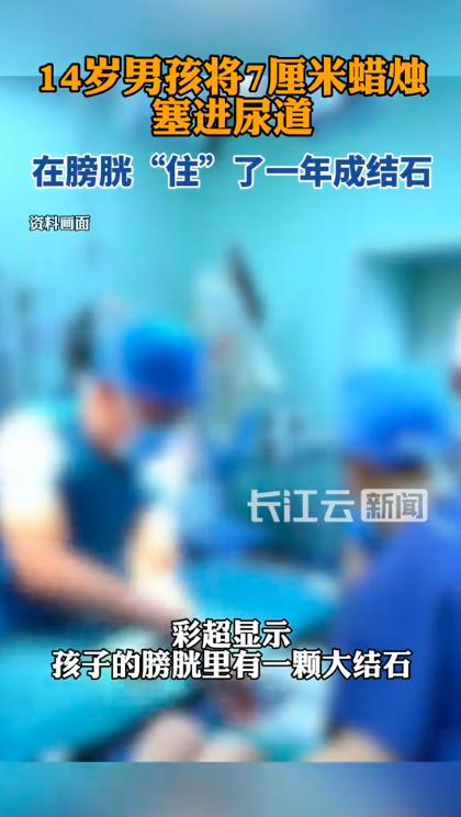 14岁男孩将7cm蜡烛塞进尿道，“住”了一年成结石？

这事就发生在河南省儿童医