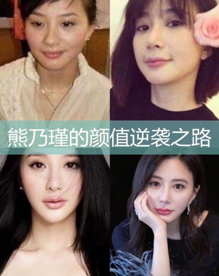 熊乃瑾否认整容  导师在综艺中直接质问整容，熊乃瑾以真诚和才华回应所有质疑，展现