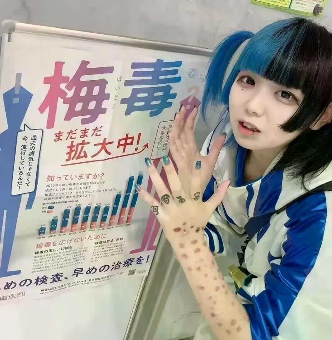 一针青霉素就能治好的病，日本竟让患者等了30多年！十年暴增10倍，2025年病例