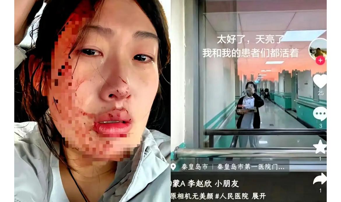 暴力人格果然要不得
​23岁女护士被打
​不是因为她技术不过硬，也不是因为她态度