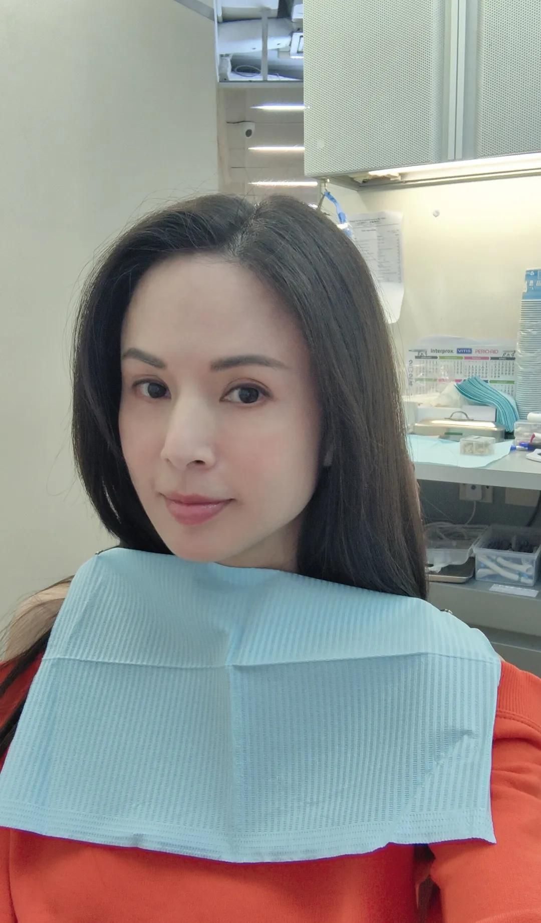 李若彤到口腔科看牙，化淡妆的她太美了，梦回小龙女啊！橘色卫衣特别显白，她的皮肤又
