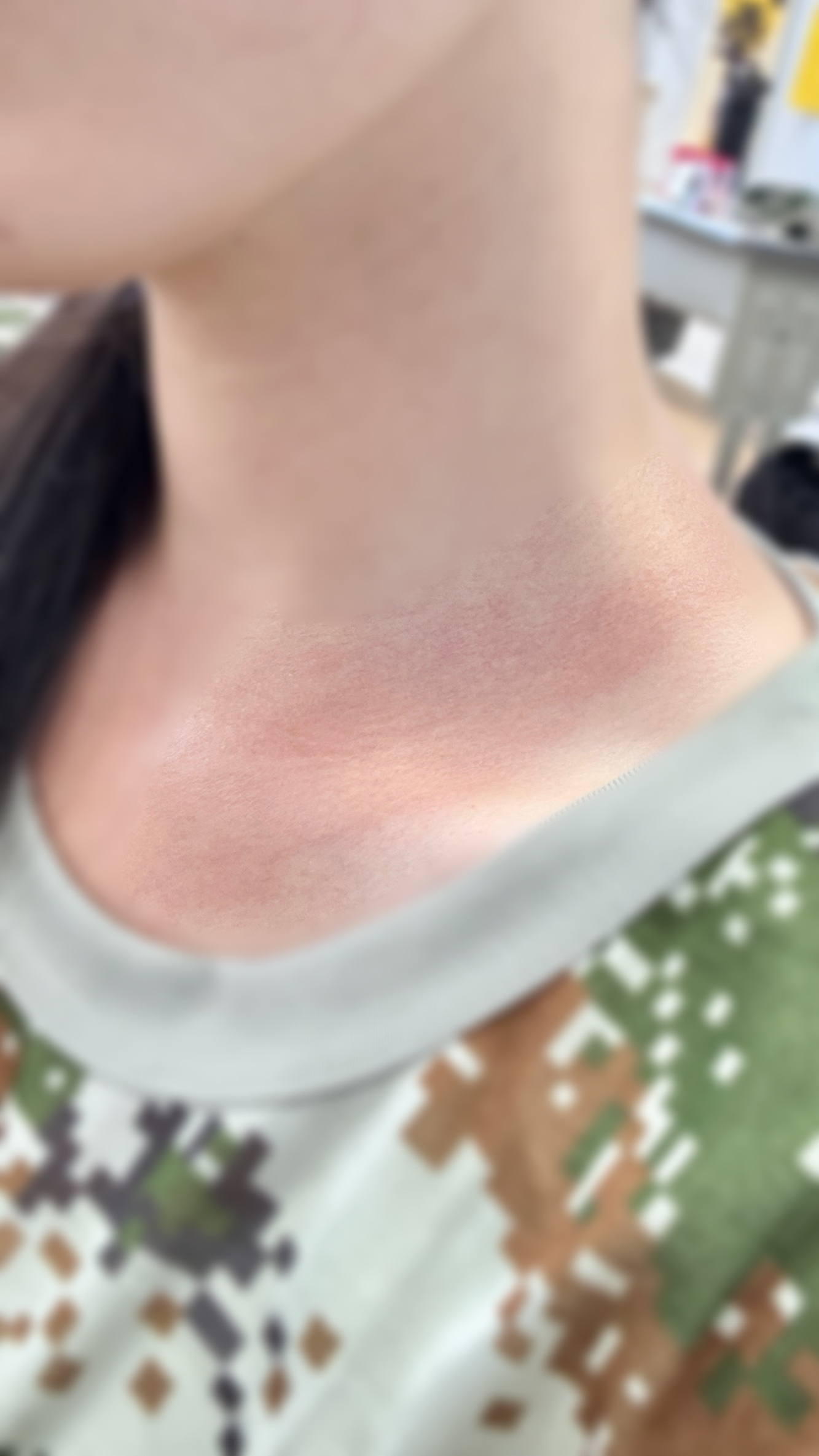脖子你自由子。 ​​​