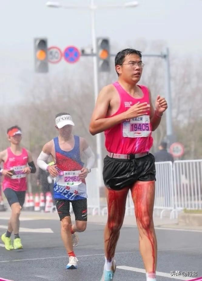 第一眼：以为是来月经了

第二眼：是个男的，不会来月经啊！

第三眼：原来是屎拉