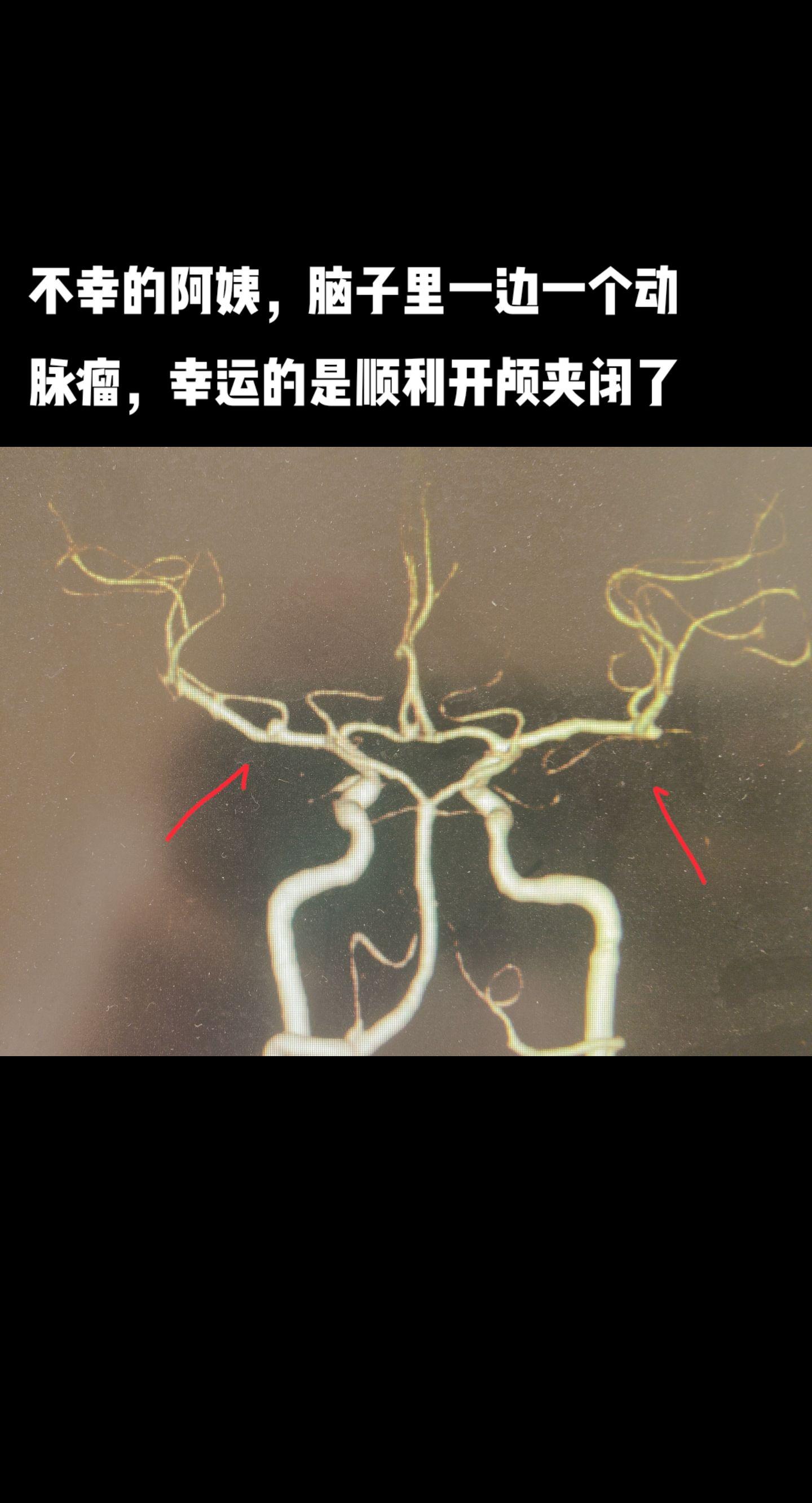 医路前行 医者仁心 手术室日常