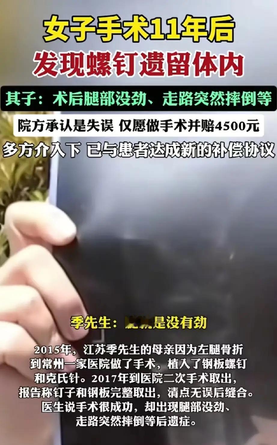 江苏常州，老人手术后，医生不小心把一个螺丝钉落在体内，导致其被病痛折磨8年。事后