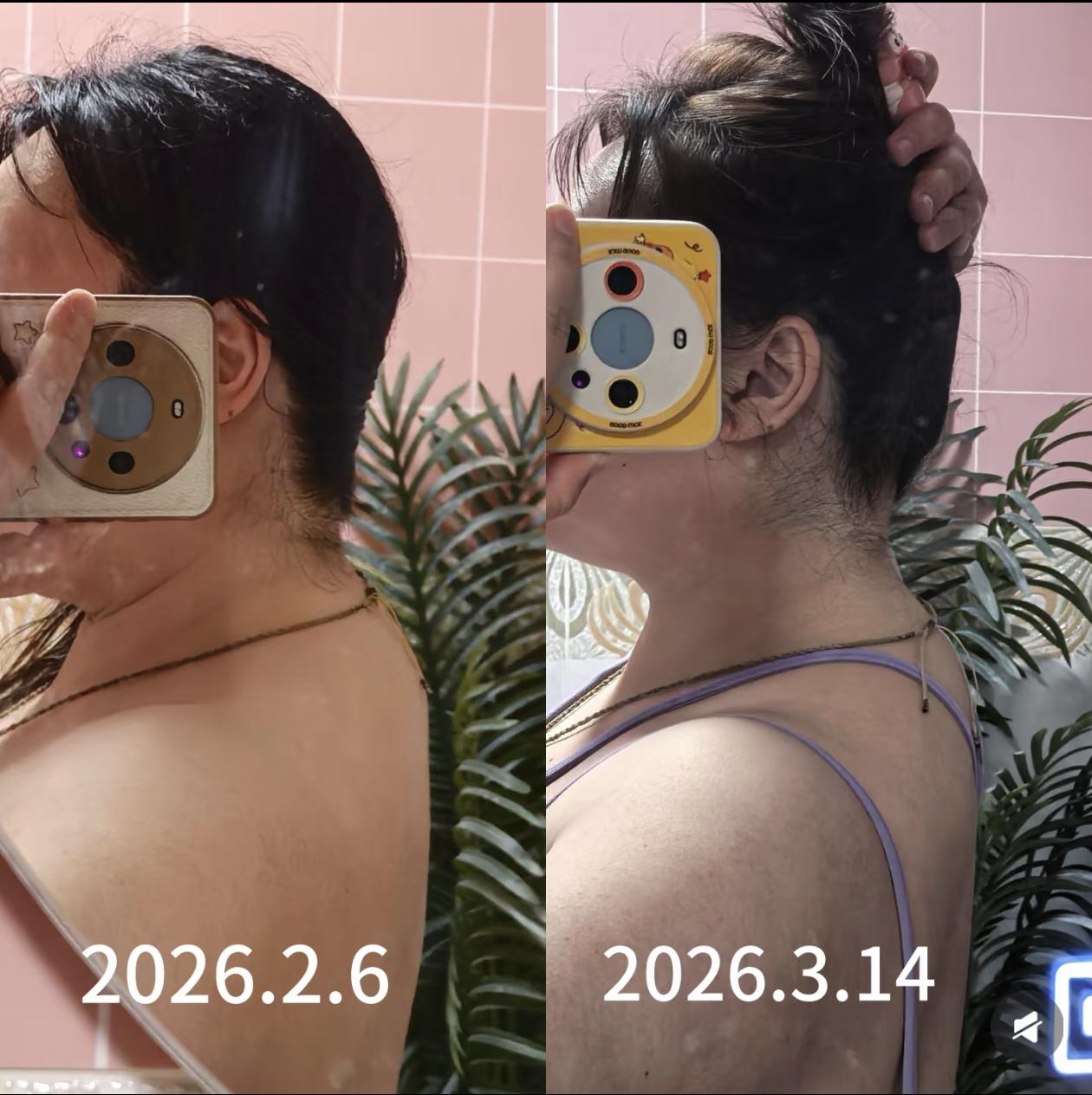 185斤体态自救｜富贵包的变化。姐妹们！你以为我天天瑜伽砖搁那儿开胸就...