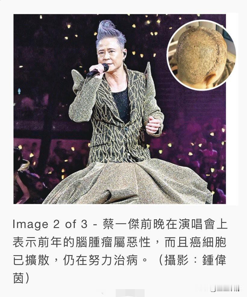 梅艳芳当年也是在病痛中坚持舞台，蔡一杰这次抗癌两年仍坚持完成演唱会，这种对舞台的