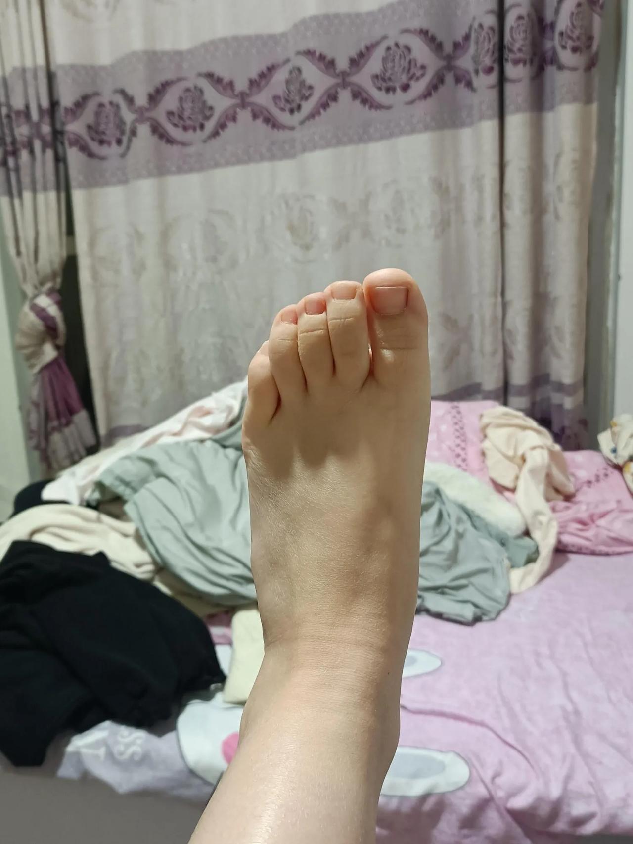 跖骨骨折后会有后遗症吗
家人们快帮我看一下，我是今年五一的时候，然后崴到脚了，结