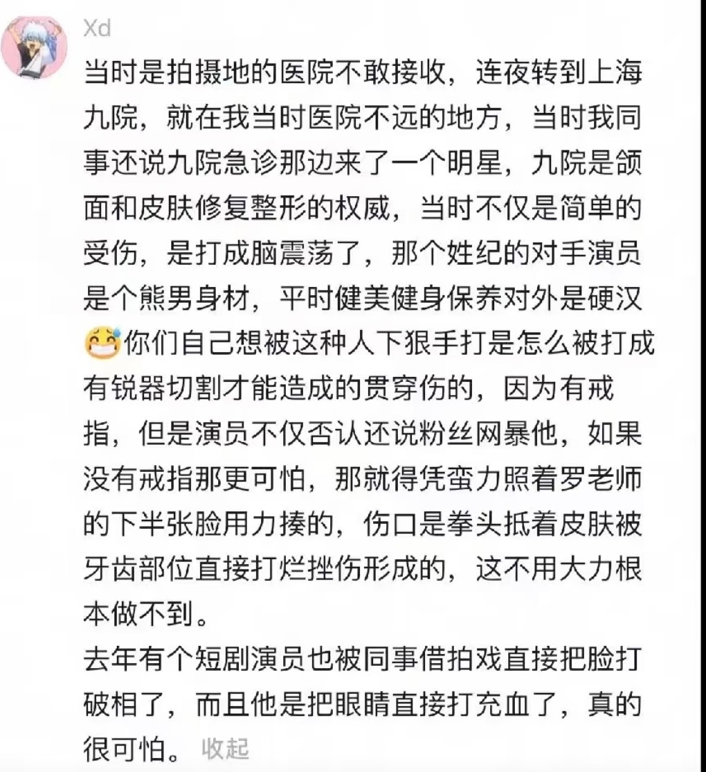 刷到一次那个纪焕博借戏打人事件就要眼睛进沙子气愤那么多人看着，摄像机拍着，代拍也