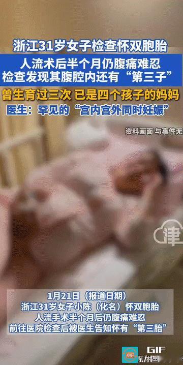 “万万没想到!”浙江，一31岁女子在一家医院完成了双胎人流手术后，本以为一切已结