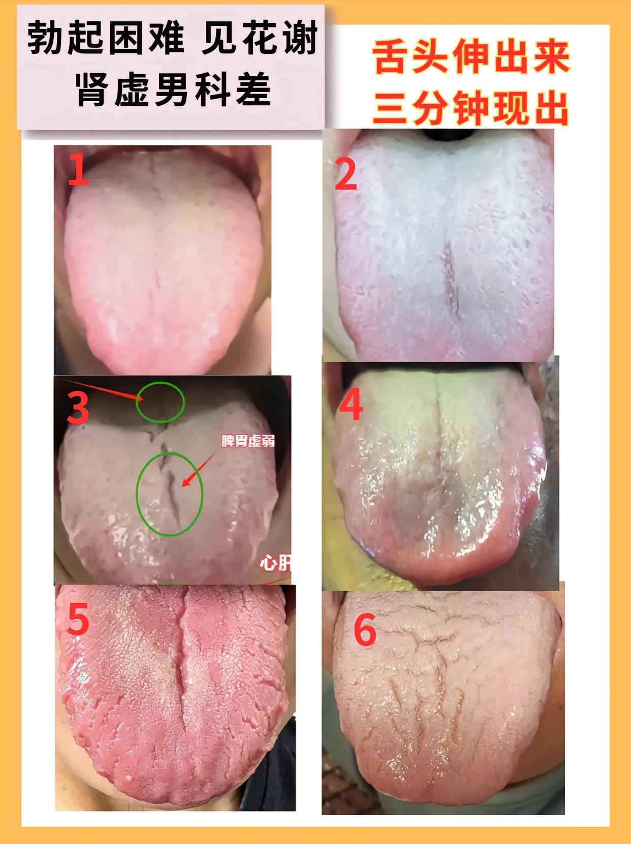男科不及格的人，一伸舌头就能看出来了，以下6种舌象，看看你是一哪种？
下午有空，