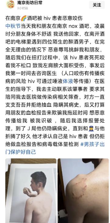 在酒吧电梯里被人死死咬住肩膀，对方还是个传染病携带者，这是要毁了人一辈子？
 