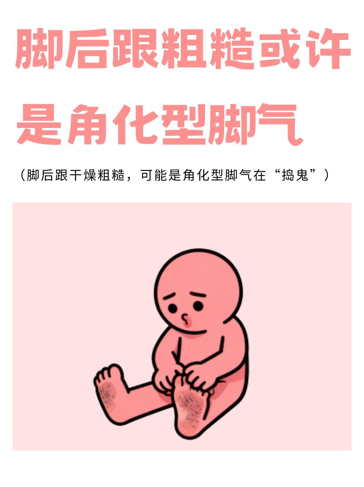 穿洞洞鞋得了角化型脚气 脚后跟起皮干裂、角质增厚，频繁涂润肤膏不见好转，可能不是