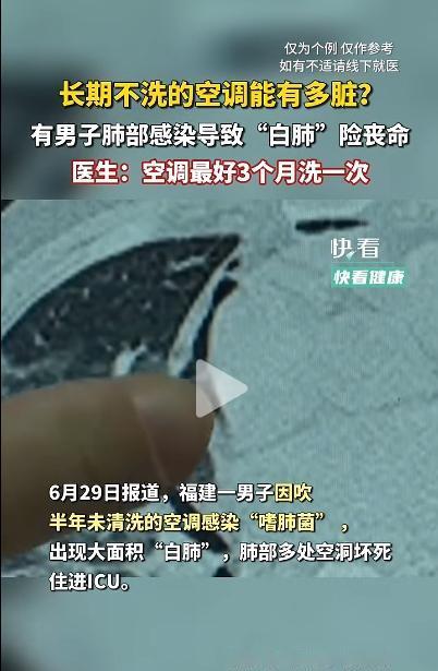 空调吹出致命肺炎，病菌发源地来自于美国，感染后病情严重
夏天到了，气温升高，吹空
