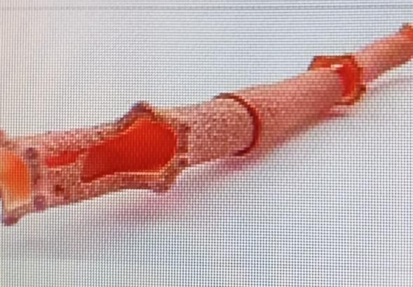 最近看到有消息说50岁以上能免费做颈动脉彩超义诊，这可太贴心了。很多人关心颈动脉