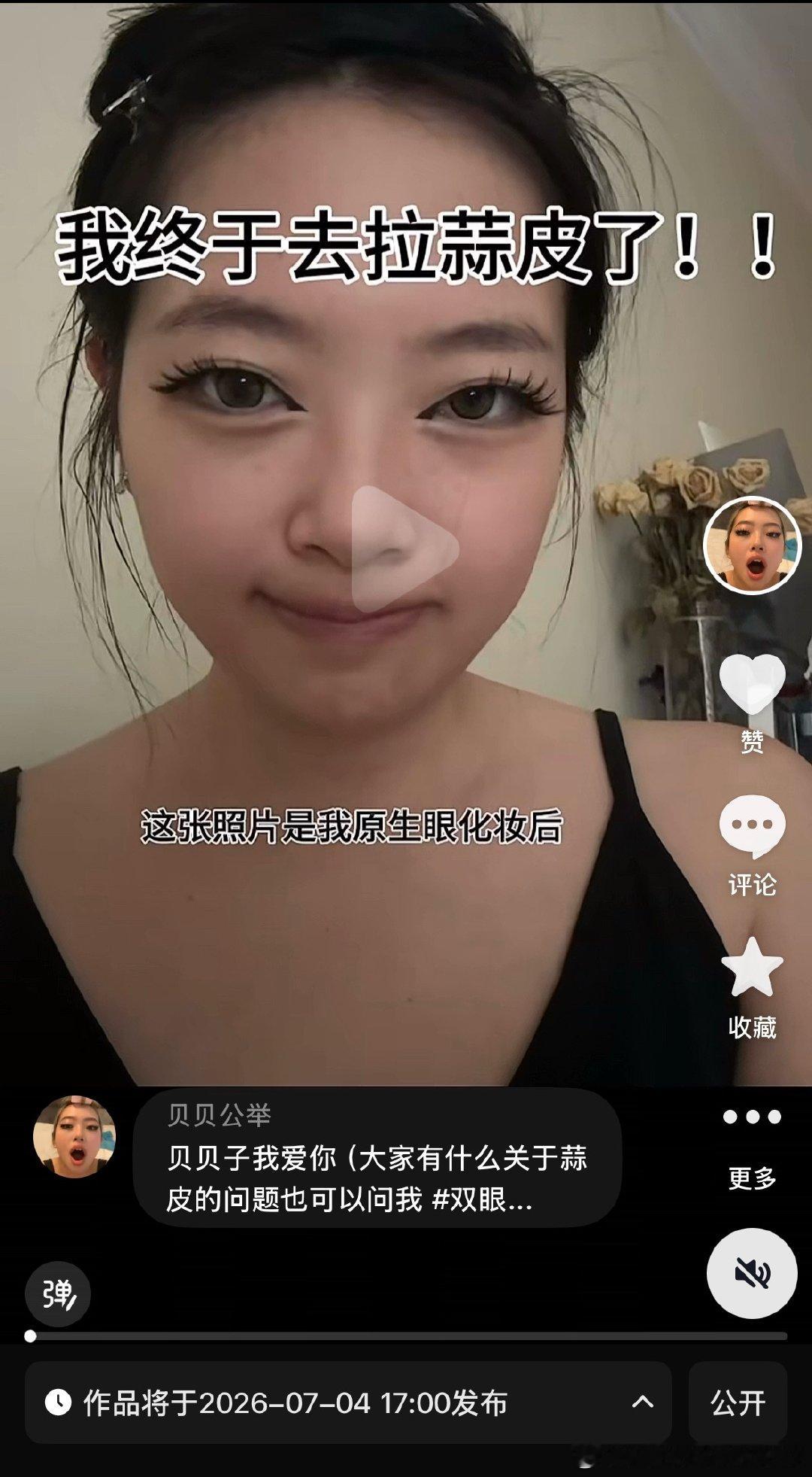 贝贝子的蒜皮恢复记录已经剪好！定时了！今晚北京时间五点抖鹰：贝贝公举 