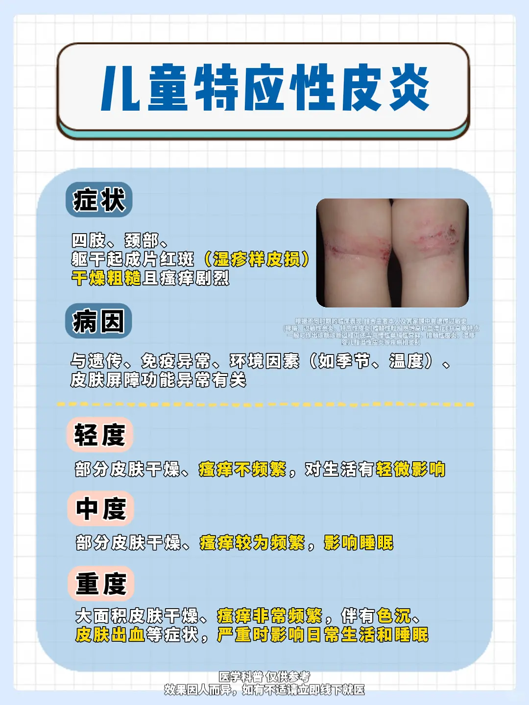 特应性皮炎不含激素外用药合集，记得收藏~。