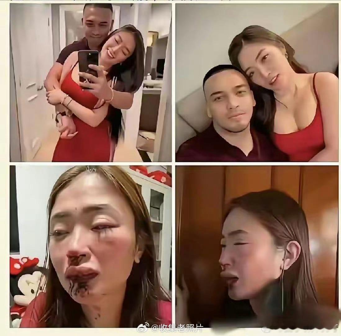 热烈祝贺外嫁女被打的头破血流
