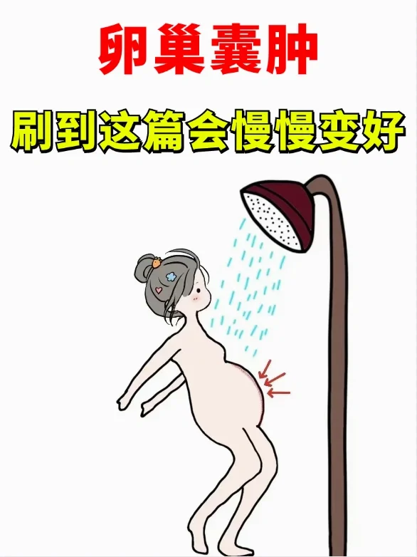 卵巢囊肿姑娘，刷到这篇都会变好❗