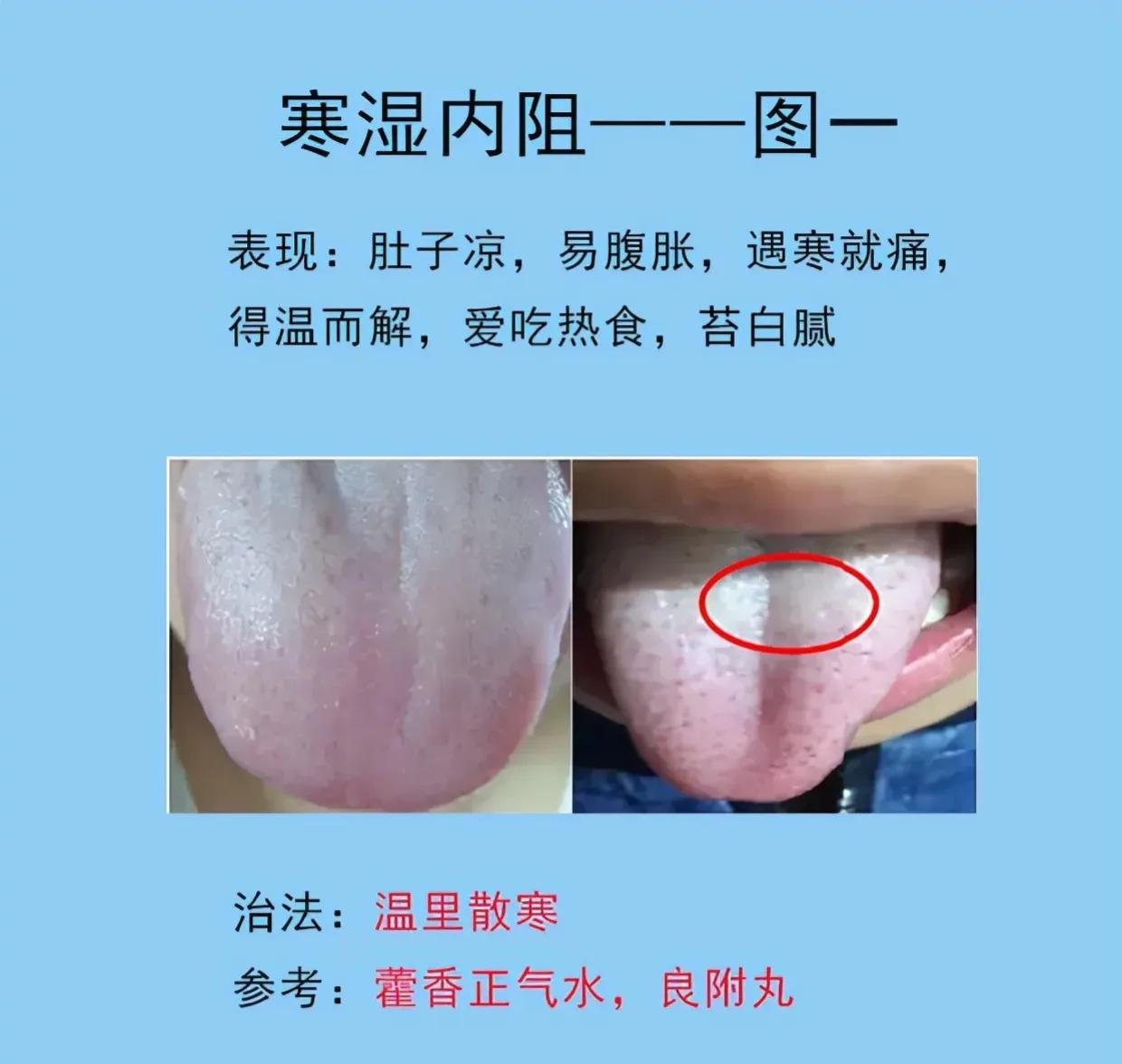 你是否经常感到脾胃不适？舌头是健康的晴雨表，通过观察舌象，我们可以了解脾胃的健康