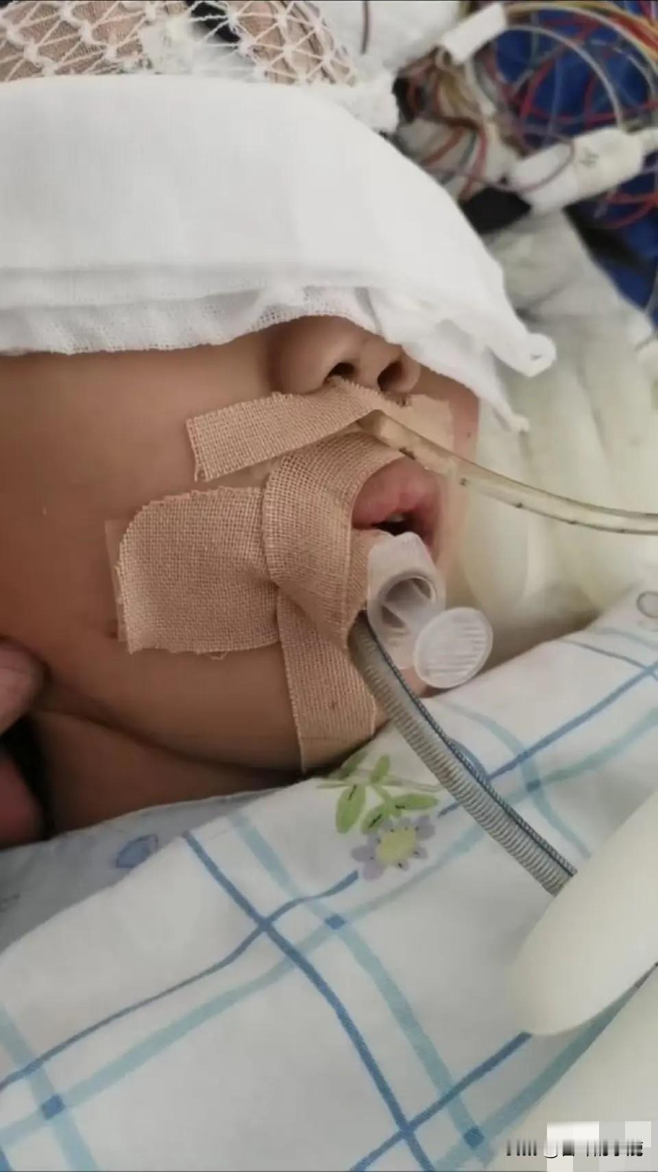 9岁的娃一个“简单小手术”，咋就成了植物人？
更离谱的是，河南省人民医院居然让多