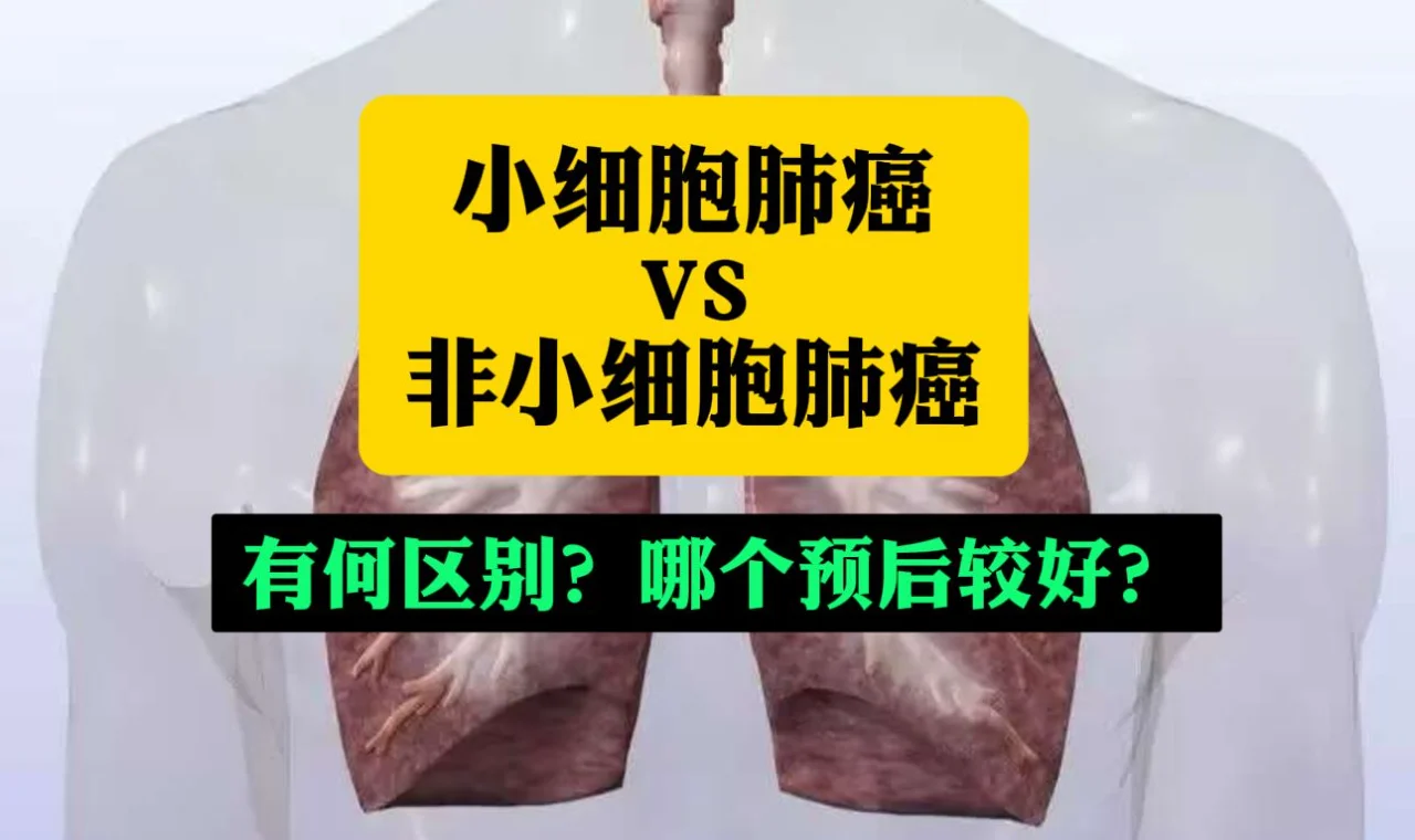 非小细胞肺癌和小细胞肺癌的区别