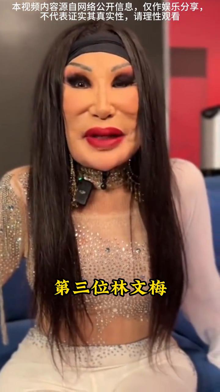 医美变毁明星。
说出来谁敢信，这四位女星竟然个个都医美变毁了。
·第一位：邵音音