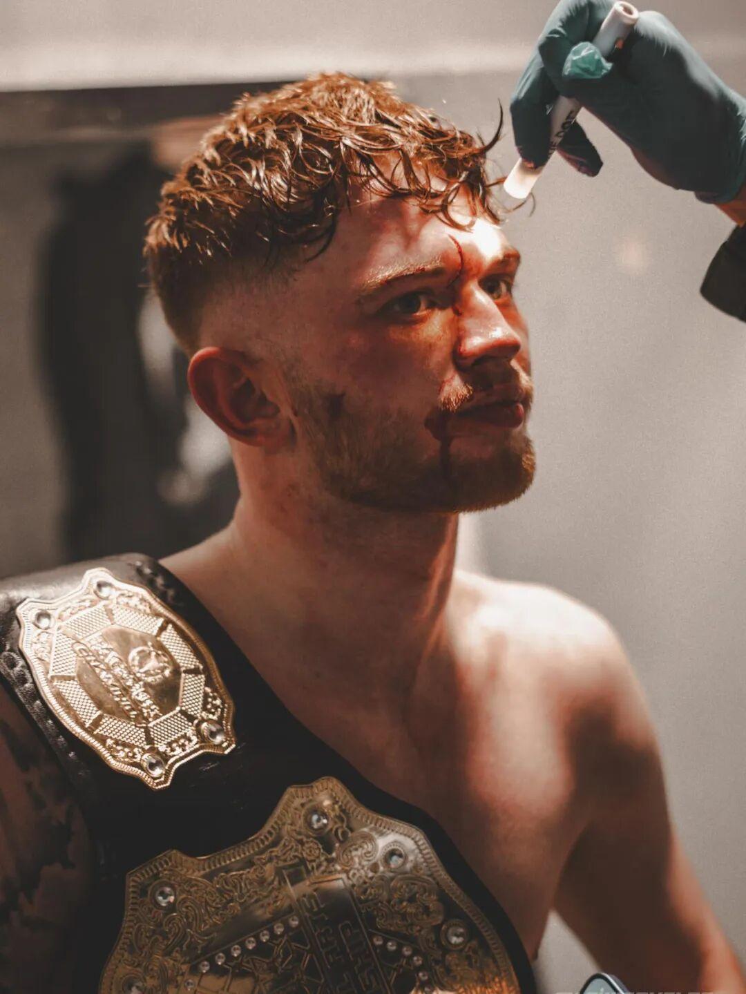 最近，英国 MMA 新人拳击手 Taylor Swift（泰勒·斯威夫特）受伤了
