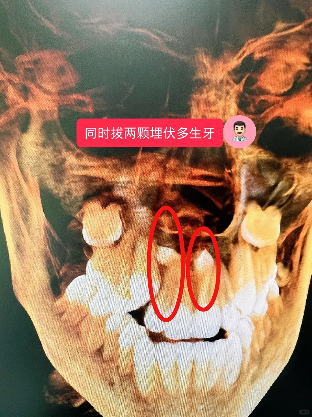 三甲医院的口腔科医生有多难？
