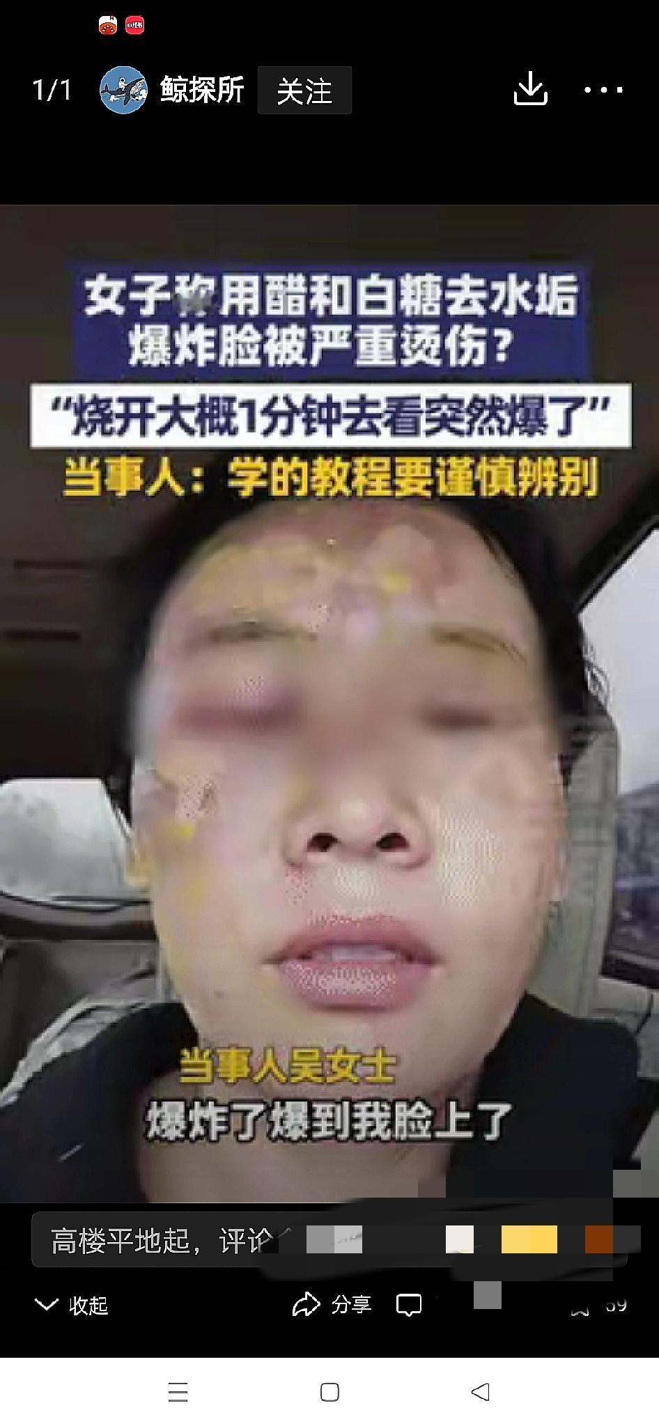 这下真的悲剧了！邯郸一位女子学网上的“除垢妙招”，

把白糖+醋倒进刚烧开的热水
