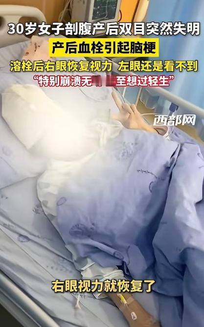 太揪心了！4月28日报道，贵州一30岁女子剖腹产后突发双眼失明，经查竟是产后血栓